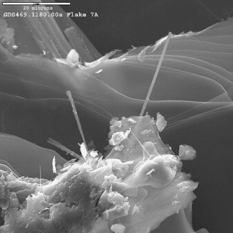 Amphibole asbestos, the type of asbestos with needle-like fibers under magnification. Source: Frank and Joshi, Annals of Global Health. Used under CC license http://creativecommons.org/licenses/by-nc-nd/3.0/