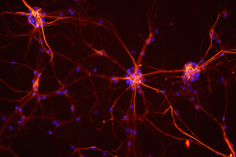 mouse-neurons